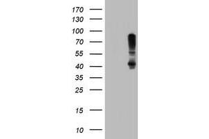 anti-serpin Peptidase Inhibitor, Clade B (Ovalbumin), Member 1 (SERPINB1) (AA 77-306) antibody
