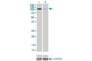 Image no. 6 for anti-Protein Kinase N1 (PKN1) (AA 462-615) antibody (ABIN562393)