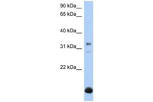 Image no. 1 for anti-UDP-Gal:betaGal beta 1,3-Galactosyltransferase Polypeptide 6 (B3GALT6) (N-Term) antibody (ABIN636025)