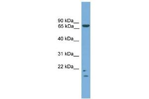 Image no. 1 for anti-MRE11 Meiotic Recombination 11 Homolog A (S. Cerevisiae) (MRE11A) (N-Term) antibody (ABIN2774155)