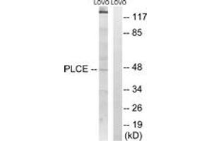 Image no. 1 for anti-1-Acylglycerol-3-Phosphate O-Acyltransferase 5 (Lysophosphatidic Acid Acyltransferase, Epsilon) (AGPAT5) (AA 241-290) antibody (ABIN1534499)