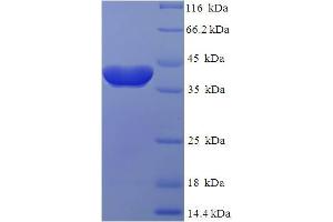 Image no. 1 for RAB2A, Member RAS Oncogene Family (RAB2A) (AA 2-212) protein (His-SUMO Tag) (ABIN5710205)