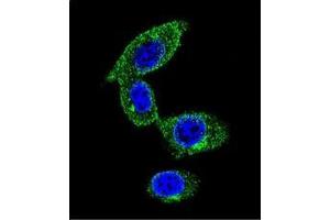 Image no. 1 for anti-Sorbin and SH3 Domain Containing 1 (SORBS1) (AA 869-896), (Middle Region) antibody (ABIN954882)
