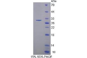 Image no. 1 for Myosin Light Chain Kinase 3 (MYLK3) (AA 555-786) protein (His tag) (ABIN6238094)