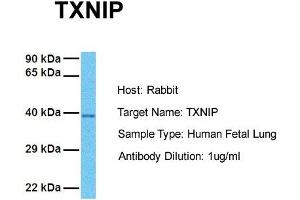Image no. 1 for anti-Thioredoxin Interacting Protein (TXNIP) (C-Term) antibody (ABIN2784817)
