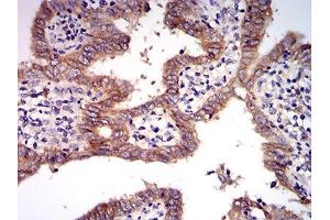 Image no. 4 for anti-Met Proto-Oncogene (MET) (AA 743-932) antibody (ABIN5542707)