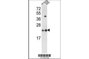 Image no. 1 for anti-SAR1 Homolog A (SAR1A) (AA 122-149) antibody (ABIN390902)