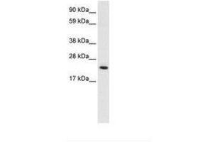 Image no. 2 for anti-High Mobility Group Box 3 (HMGB3) (C-Term) antibody (ABIN203028)