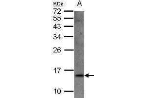 Image no. 1 for anti-Signal Recognition Particle 14kDa (Homologous Alu RNA Binding Protein) (SRP14) (Center) antibody (ABIN2855206)