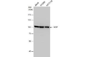 WB Image VCP antibody detects VCP protein by western blot analysis.