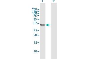 Image no. 2 for anti-E2F Transcription Factor 6 (E2F6) (AA 1-281) antibody (ABIN515129)
