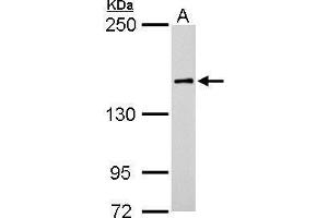 Image no. 5 for anti-rho-Associated, Coiled-Coil Containing Protein Kinase 1 (ROCK1) (N-Term) antibody (ABIN2856887)