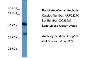 Image no. 2 for anti-ArfGAP with Dual PH Domains 1 (ADAP1) (C-Term) antibody (ABIN2784853)