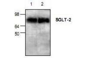 Image no. 1 for anti-Solute Carrier Family 5 (Sodium/glucose Cotransporter), Member 2 (SLC5A2) (N-Term) antibody (ABIN223369)