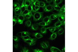 Immunofluorescence (IF) image for anti-beta-2-Microglobulin (B2M) antibody (ABIN6940416)