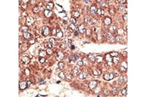 Image no. 2 for anti-Low Density Lipoprotein Receptor-Related Protein 2 (LRP2) (AA 4626-4655) antibody (ABIN3031639)
