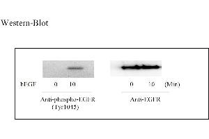 Image no. 4 for Epidermal Growth Factor Receptor (EGFR) ELISA Kit (ABIN625235)