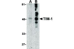 Image no. 1 for anti-Hepatitis A Virus Cellular Receptor 1 (HAVCR1) (N-Term) antibody (ABIN6655882)