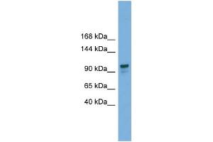 Image no. 2 for anti-Glucosidase, Alpha, Neutral AB (GANAB) (Middle Region) antibody (ABIN2786407)