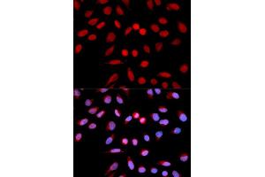 Image no. 2 for anti-Protein Phosphatase 1, Catalytic Subunit, alpha Isoform (PPP1CA) antibody (ABIN1874217)