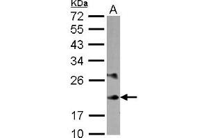 Image no. 1 for anti-Myosin, Light Chain 6B, Alkali, Smooth Muscle and Non-Muscle (MYL6B) (AA 1-208) antibody (ABIN1499618)