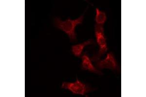 Image no. 1 for anti-V-Raf-1 Murine Leukemia Viral Oncogene Homolog 1 (RAF1) (pSer338) antibody (ABIN6255230)