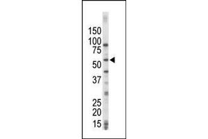 Image no. 1 for anti-Mitogen-Activated Protein Kinase Kinase Kinase 8 (MAP3K8) (AA 368-397), (C-Term) antibody (ABIN392472)