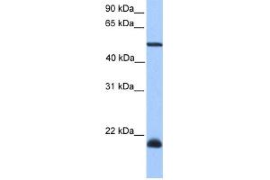 Image no. 1 for anti-Dyslexia Susceptibility 1 Candidate 1 (DYX1C1) (C-Term) antibody (ABIN2784979)