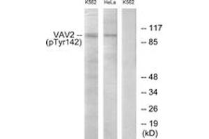 Western blot analysis of extracts from HeLa cells and K562 cells treated with TNF 20ng/ml 30', using VAV2 (Phospho-Tyr142) Antibody.