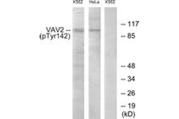 anti-Vav 2 Guanine Nucleotide Exchange Factor (VAV2) (AA 108-157), (pTyr142) antibody