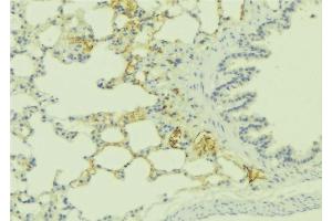 Image no. 3 for anti-Endothelin Receptor Type A (EDNRA) antibody (ABIN6257158)