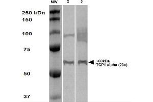 Western Blot analysis of Human A431 and HEK293 cell lysates showing detection of TCP1 alpha protein using Rat Anti-TCP1 alpha Monoclonal Antibody, Clone 23c .