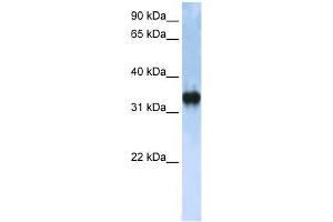 Image no. 1 for anti-Zinc Finger, CCHC Domain Containing 17 (ZCCHC17) (C-Term) antibody (ABIN633319)