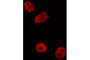 Image no. 3 for anti-Transcription Factor AP-2 alpha (Activating Enhancer Binding Protein 2 Alpha) (TFAP2A) (C-Term) antibody (ABIN6259960)