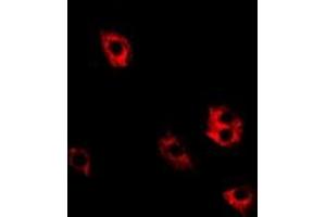 Image no. 3 for anti-Signal Recognition Particle 19kDa (SRP19) (full length) antibody (ABIN6004686)