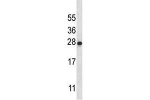 Image no. 1 for anti-Interleukin 22 (IL22) (AA 44-73) antibody (ABIN3028760)