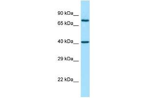 Image no. 1 for anti-Matrix Metallopeptidase 28 (MMP28) (N-Term) antibody (ABIN2789963)
