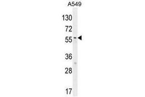 Image no. 3 for anti-Syncoilin (Sync) (AA 133-163), (N-Term) antibody (ABIN955027)