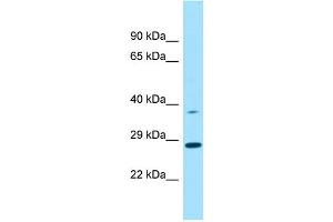 Image no. 1 for anti-Collectin Sub-Family Member 10 (C-Type Lectin) (COLEC10) (N-Term) antibody (ABIN2790619)
