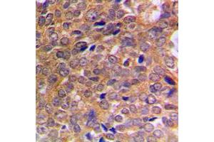 Image no. 2 for anti-Abelson Murine Leukemia Viral Oncogene Homolog 1/2 (ABL1/ABL2) (C-Term), (pTyr393), (pTyr439) antibody (ABIN2704442)