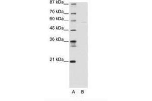 Image no. 1 for anti-SWI/SNF Related, Matrix Associated, Actin Dependent Regulator of Chromatin, Subfamily D, Member 3 (SMARCD3) (AA 139-188) antibody (ABIN6736140)