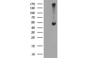 Image no. 1 for anti-Adipocyte Plasma Membrane Associated Protein (APMAP) antibody (ABIN2716269)