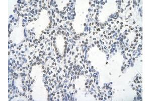 Image no. 3 for anti-FOS-Like Antigen 1 (FOSL1) (Middle Region) antibody (ABIN2777265)
