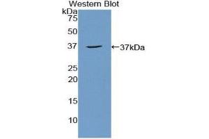 Image no. 1 for anti-Apoptosis Antagonizing Transcription Factor (AATF) (AA 237-523) antibody (ABIN1857853)