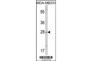 Western Blotting (WB) image for anti-Collectin Sub-Family Member 11 (COLEC11) antibody (ABIN2158324)