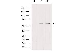 Image no. 1 for anti-Cyclin Dependent Kinase Like 2 (CDKL2) (Internal Region) antibody (ABIN6258386)