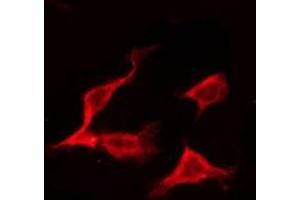 Image no. 1 for anti-ES cell expressed Ras (ERAS) (C-Term) antibody (ABIN6258133)