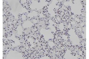 Image no. 3 for anti-Jun B Proto-Oncogene (JUNB) (pThr255) antibody (ABIN6269895)