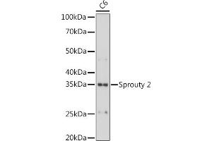SPRY2 anticorps