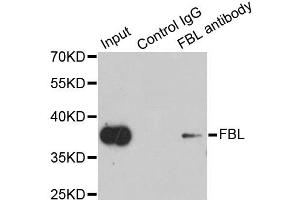 Image no. 3 for anti-Fibrillarin (FBL) antibody (ABIN6567124)